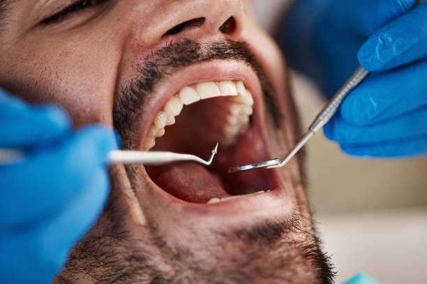 Best Urgent Dental Care for Toothache in Clinton, OK